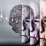 Болезнь Альцгеймера можно лечить корицей