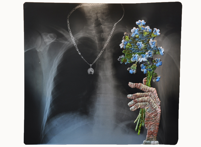 Расшитые рентгеновские снимки от Мэтью Кокс из Филадельфии 