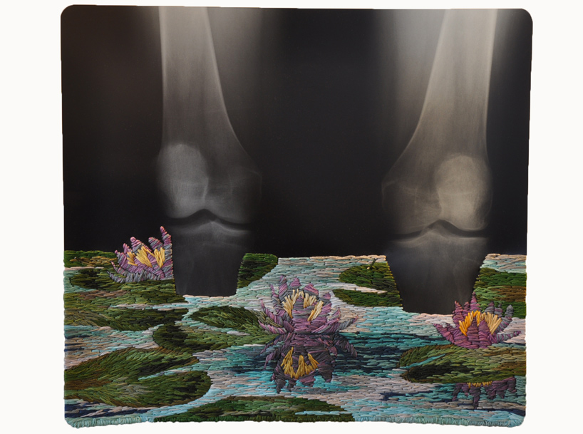 Расшитые рентгеновские снимки от Мэтью Кокс из Филадельфии 