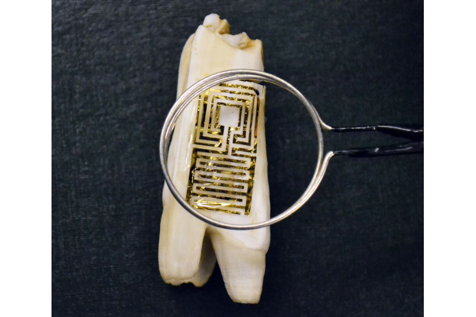 Датчик из золота и графена, прикрепленный к зубу коровы, чтобы сигнализировать о кариесе