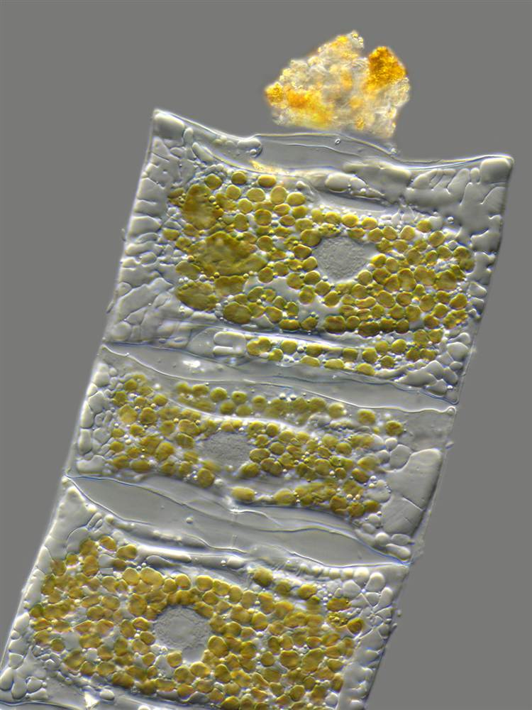 Клеточные ядра золотых хлоропласт - 9 место
